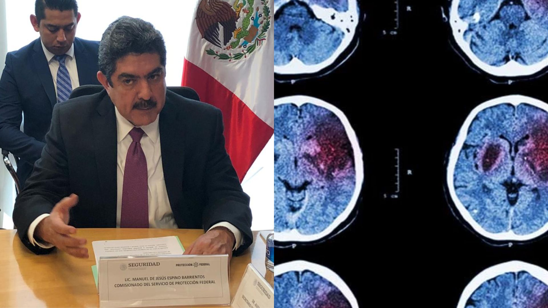 Por un fuerte derrame cerebral, operaron de emergencia al diputado Manuel Espino