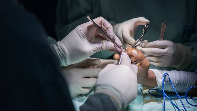 Buscan sancionar cirugías estéticas en menores de edad en Puebla