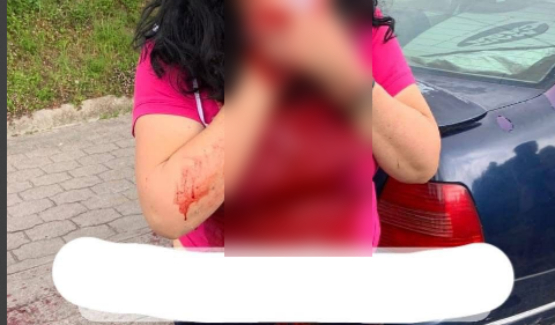Apuñalan a una mujer durante intento de asalto en Tlatlauquitepec