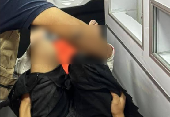 Menor cae en tina con agua hirviendo en Chignautla