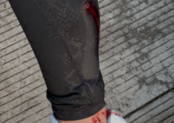 Perro ataca a mujer cuando iba en su moto en Ciudad Serdán