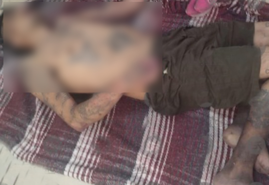 Muere de un supuesto infarto recluso del Cereso de Puebla