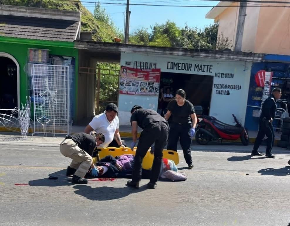 Atropella camioneta a mujer en calles céntricas de Xiutetelco 