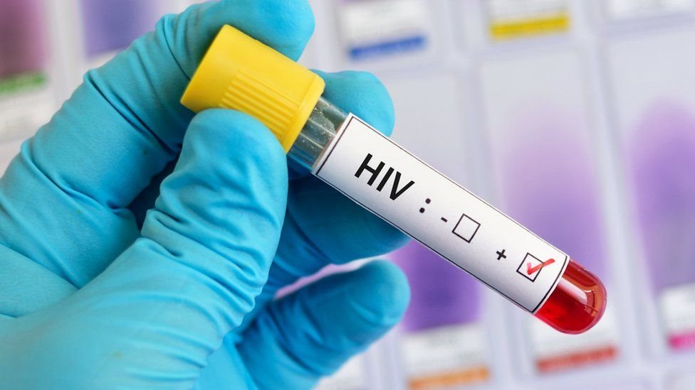 Puebla atiende a casi 6 mil personas con VIH con tratamiento antirretroviral: Salud
