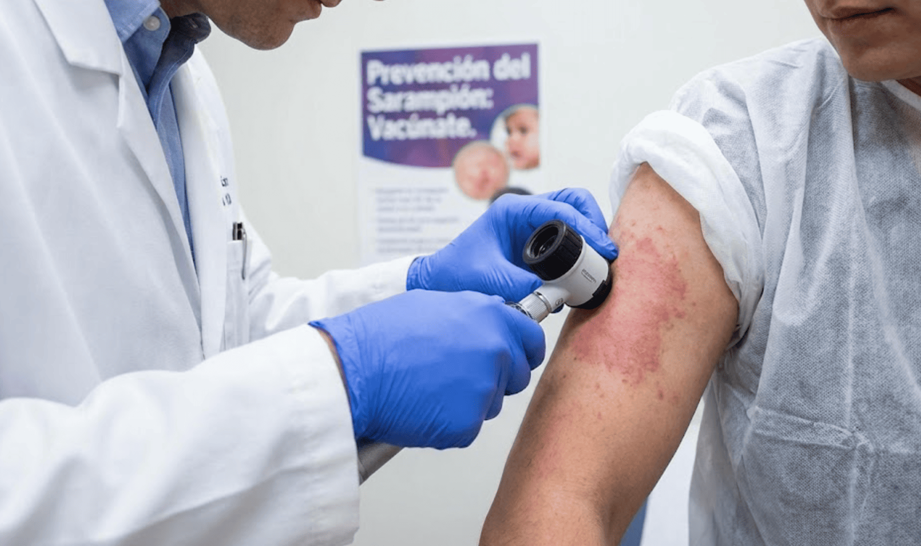 Gobierno de San Martín Texmelucan exhorta a reforzar medidas sanitarias ante casos de sarampión