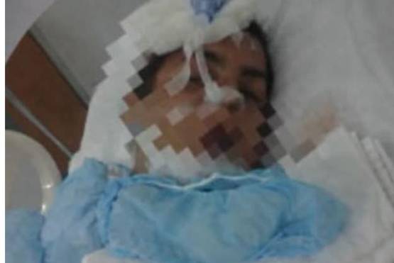 Balean a hombre y lo dejan tirado en ciclopista en Nopalucan