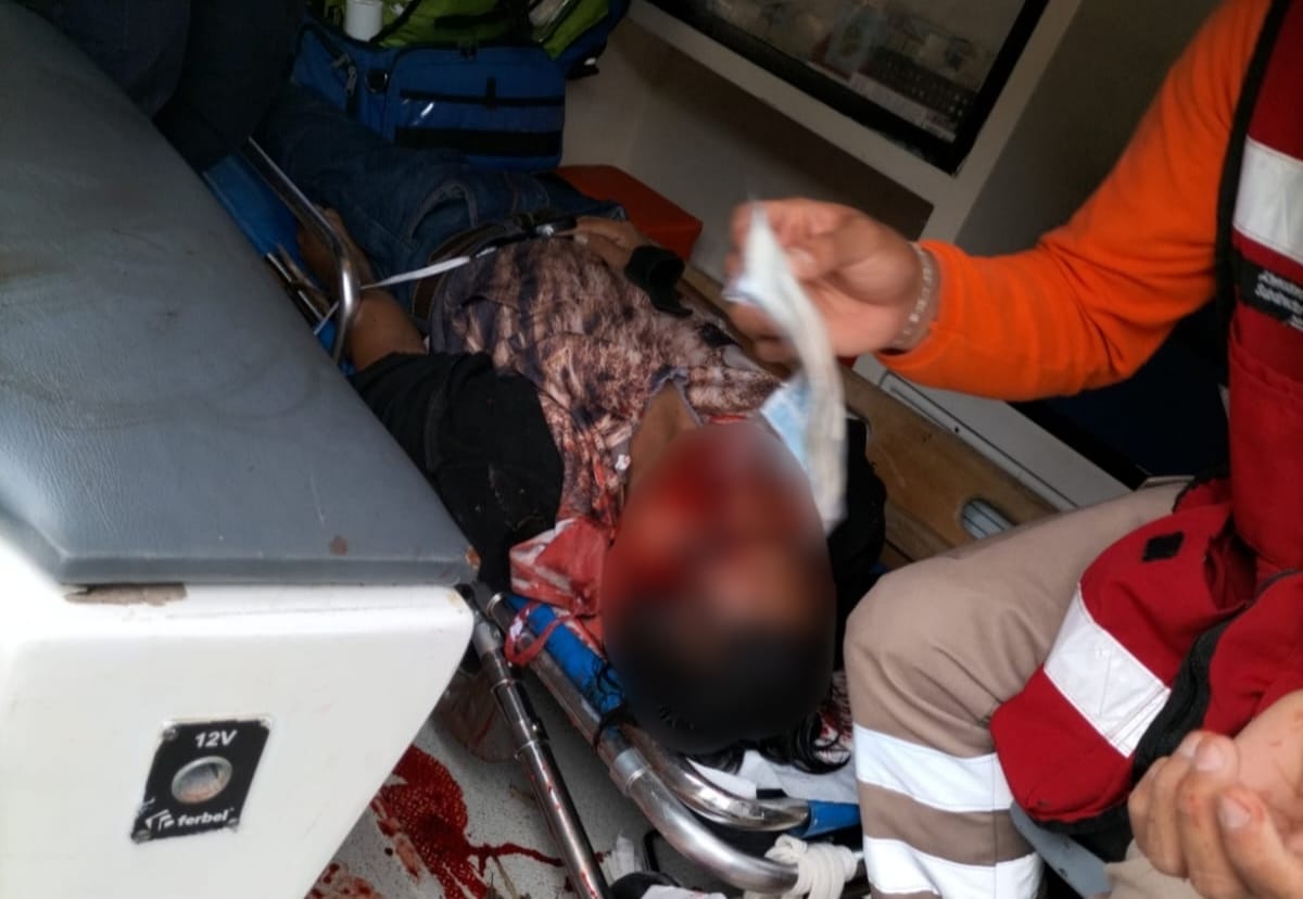 Muere motociclista en fatal accidente en Hueytamalco