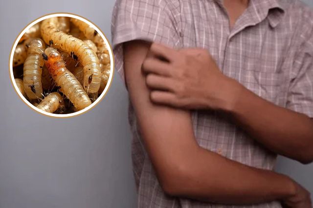 Miasis humana llega a Puebla tras brote previo en ganado por gusano barrenador