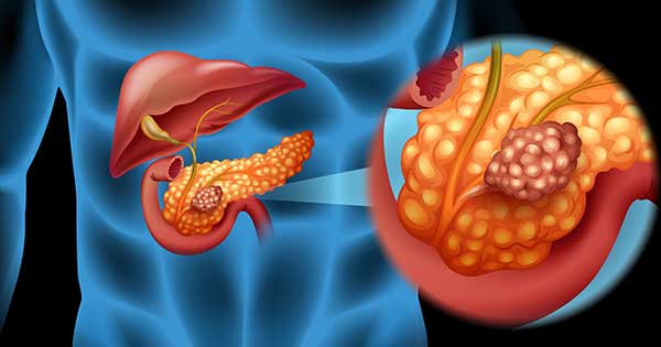 Vacuna experimental con ARNm ofrece mayor supervivencia en cáncer de páncreas