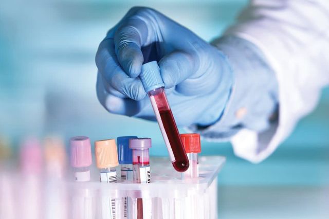 Nuevo análisis de sangre detecta fases tempranas del Alzheimer