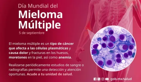 Mieloma múltiple se presenta en personas de edad media o mayores de 60 años.