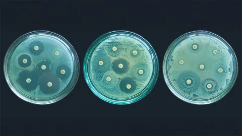 Presentan proyectos para combatir la resistencia antimicrobiana.