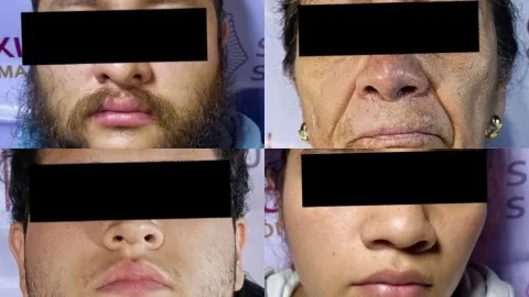 Cae familia de narcomenudistas en la CDMX, liderados por mujer de 74 años