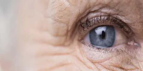 En el 2022 había más de 200 millones de personas con degeneración macular relacionada con la edad en el mundo.