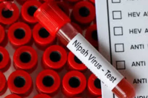 nipah