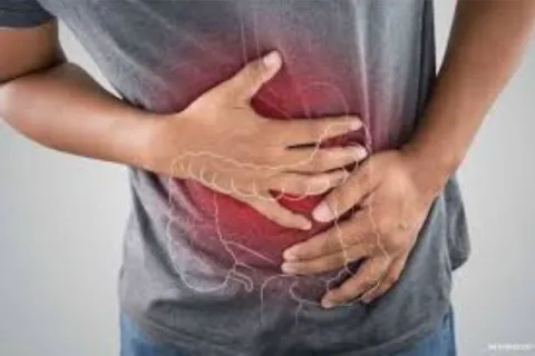 colitis